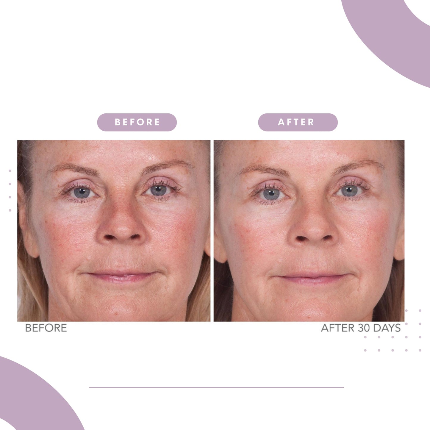 Serious Skincare Reverse Lift Firming Face Serum - Argifirm™ Lifting Complex - Temporarily Tighten - Lift – Firm - Sagging Facial Contours - Peptides - Seaweed and Botanical Extracts - 1.0 Fl. Oz.
