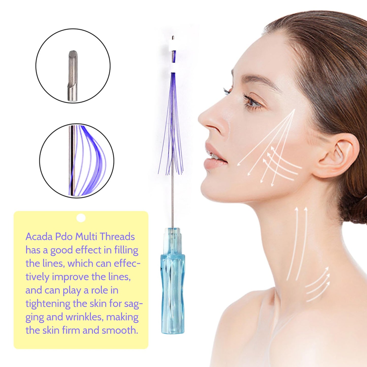 ACADA Pdo Threads for Face Lift Cog Pdo Multi Threads 23G 60mm, Cog PDO Threads L-Type Blunt, Professional Skin Tightening & Lifting Solution, 20Pcs
