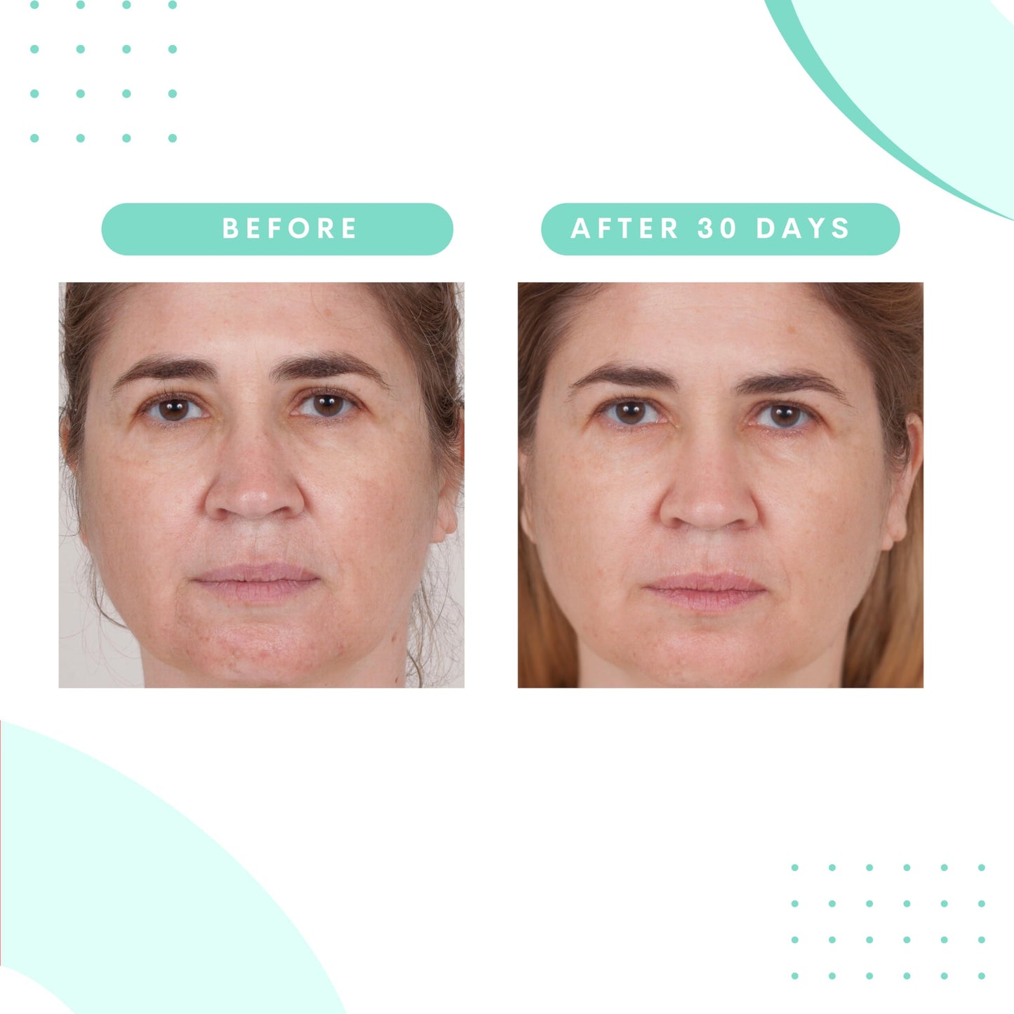 Serious Skincare Glycolic Extreme Skin Renewal Face Cream & Serum Set - Resurfacing Glycolic Acid - Blue Tansy - Reduces the Appearance of Fine Lines and Wrinkles - Anti-Aging for Face and Neck