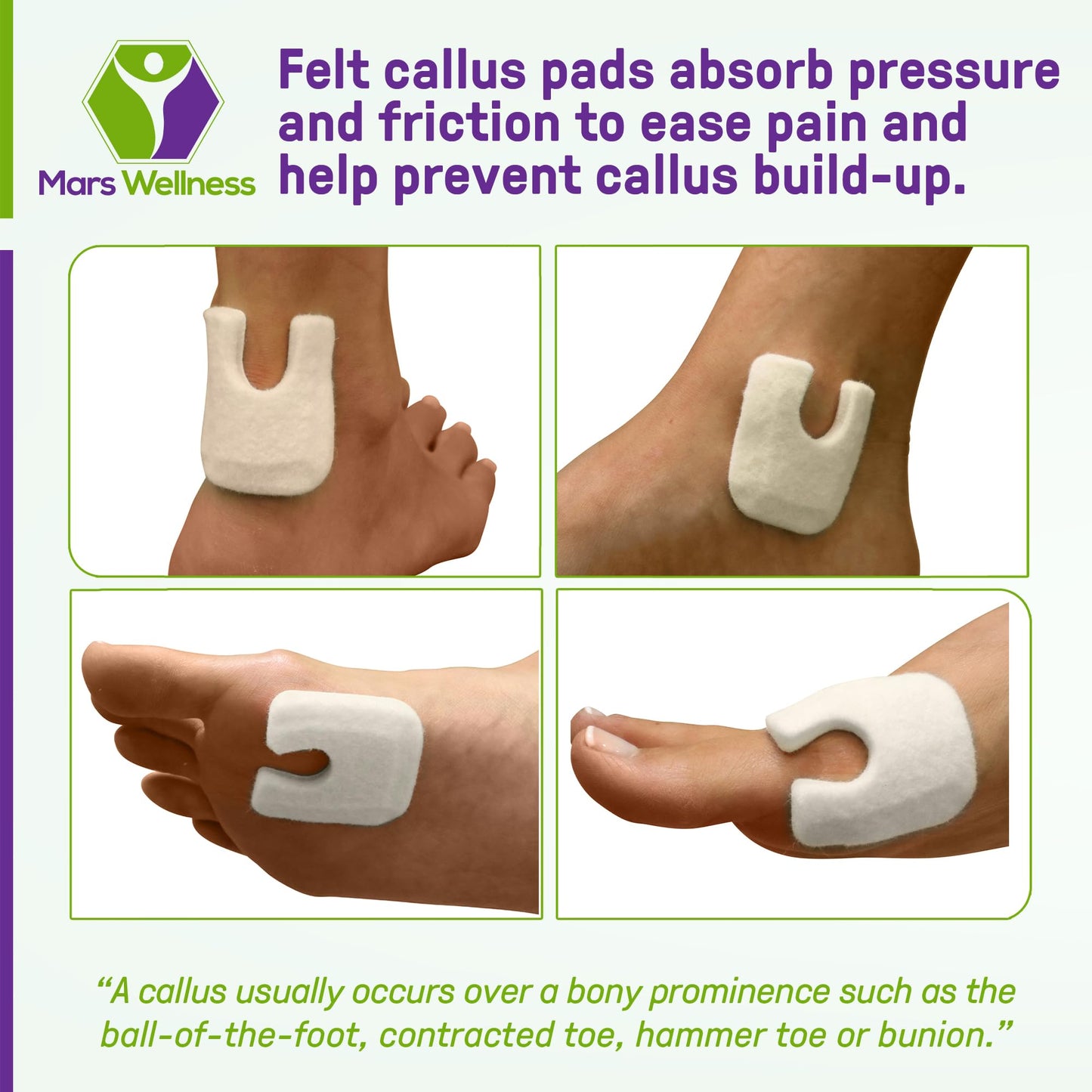 U Shaped Skived Felt Callus Horseshoe Pads - Adhesive Foot Pads That Protect Calluses from Rubbing On Shoes - Skived 1/4" - 50 Pack