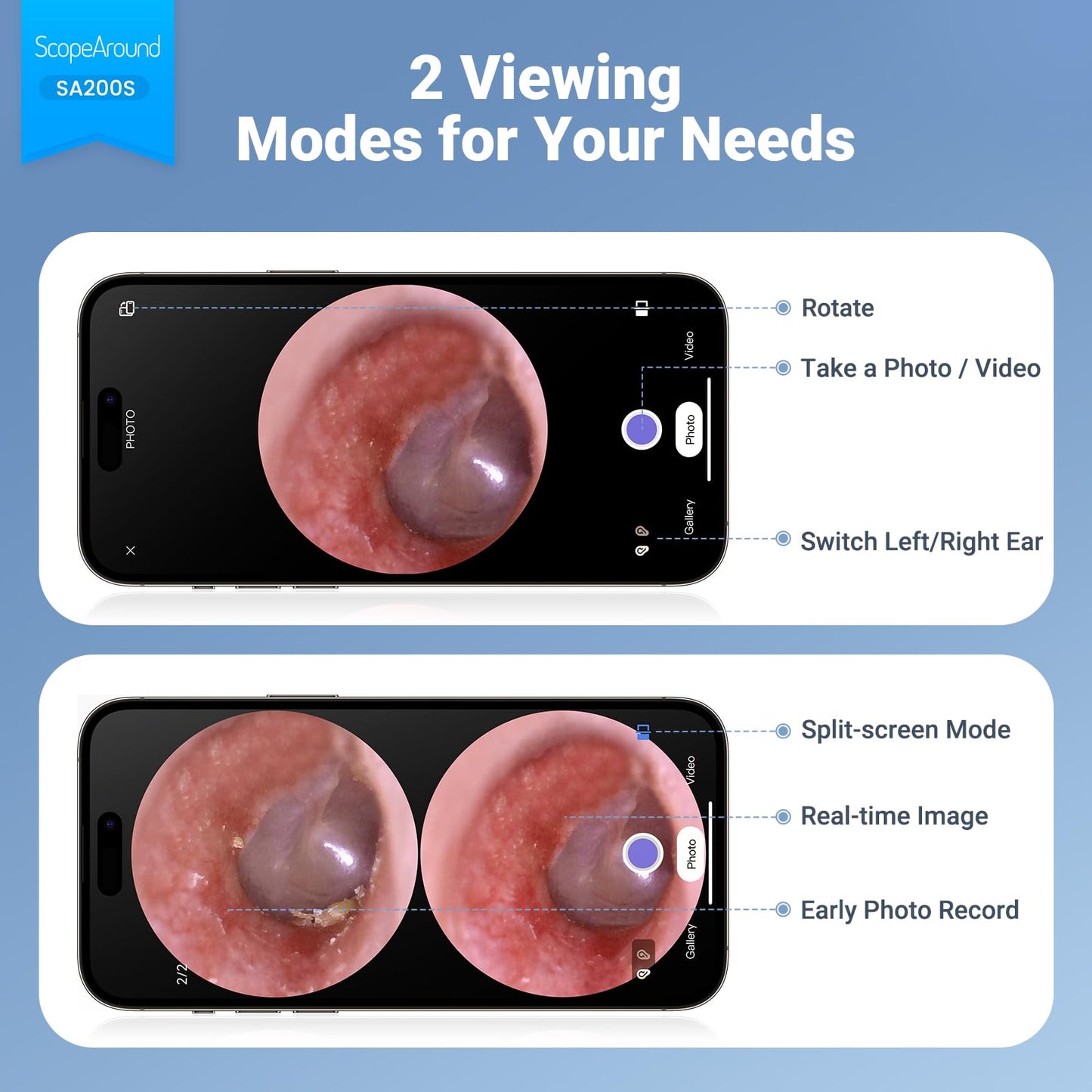 ScopeAround Otoscope with Light, Digital Otoscope w/1.85in IPS Screen, 720p HD Ear Wax Removal Tool Camera, Video Otoscope Ear Camera with 6 LED Lights, Compatible with Android/iPhone