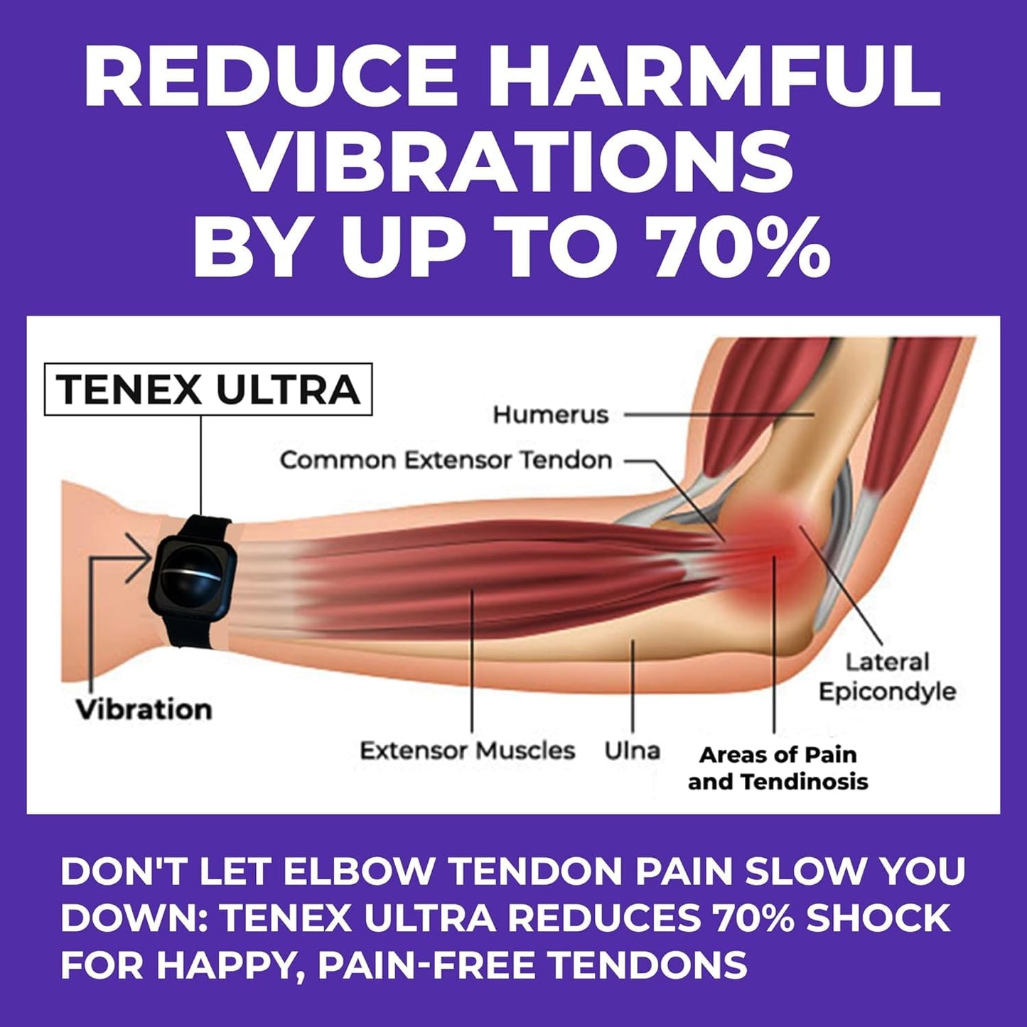 TENEX Ultra Tennis Elbow Brace, Wrist-worn Non-Compression Dampener Band, Supports Relief from Tennis, Pickleball, Golf, Repetitive Motion Tendonitis, Absorbs Shocks That Cause Pain in Men & Women
