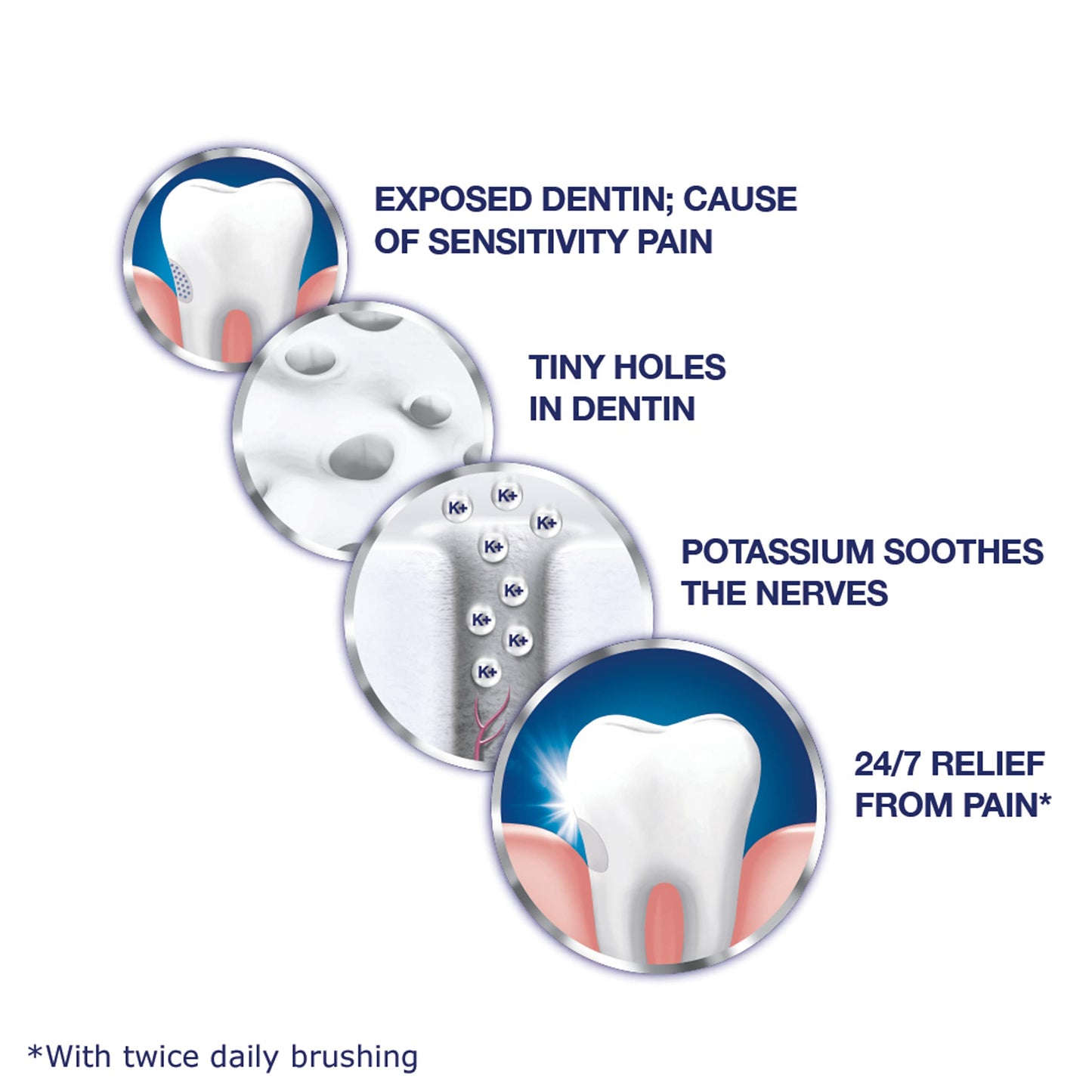 Sensodyne Toothpaste Mint, 4 Oz, Pack of 4