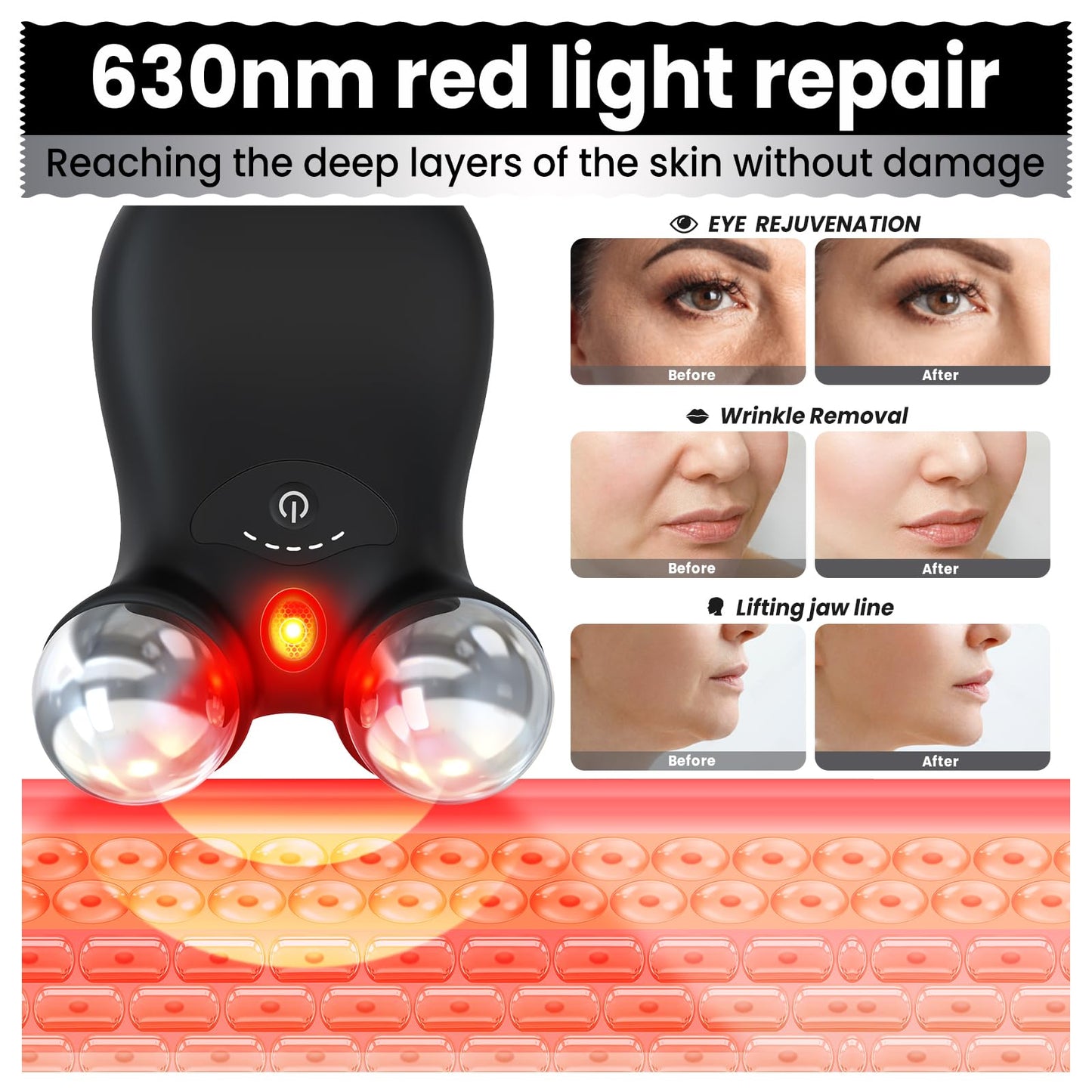 Microcurrent Facial Device,Latest Red Light Technology,Enhances The Ability to Lift The Face and Tighten The Skin,Facial Wrinkle Equipment,Smart Photon Micro-Current Device,Model:EP-300. (Black)
