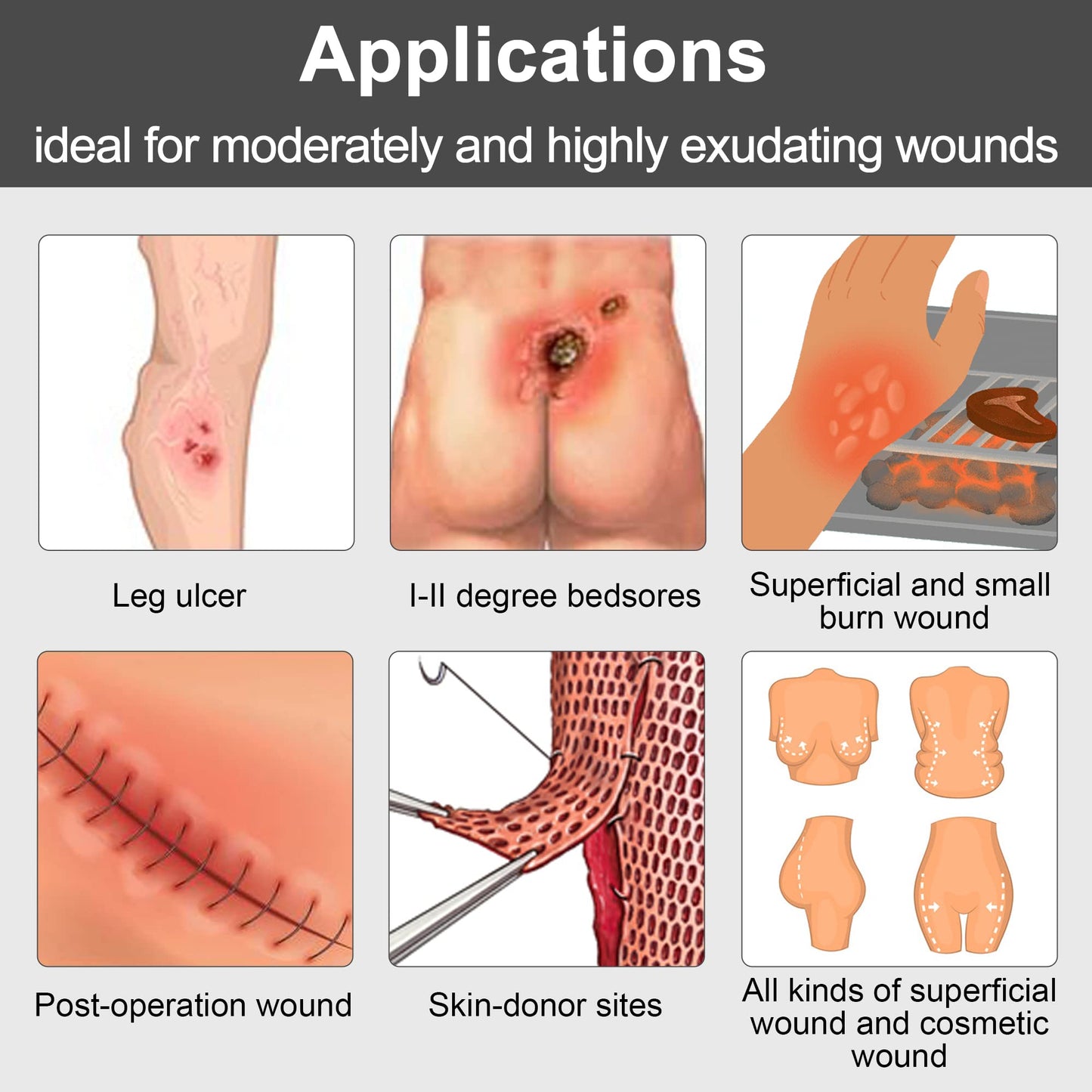 LotFancy Sacral Foam Dressing, 10 Count, 7"x 7", Silicone Foam Dressing, Wound Dressing with Border, Sacrum, Bed Sores, Pressure Ulcers Adhesive Bandage Pad, Highly Absorbent, FSA HSA Eligible