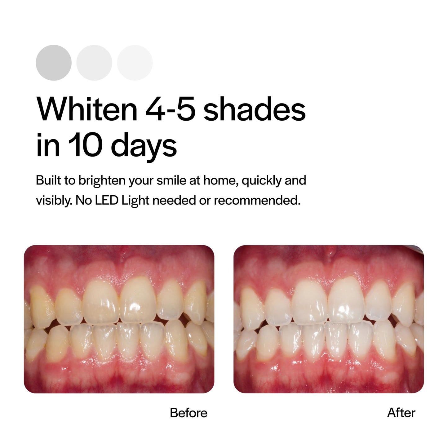 Opalescence Go - Prefilled Teeth Whitening Trays - Original 15% - 4 Treatments (2 Packs) - Hydrogen Peroxide with PF - Cool Mint - Made by Ultradent. 4648-2