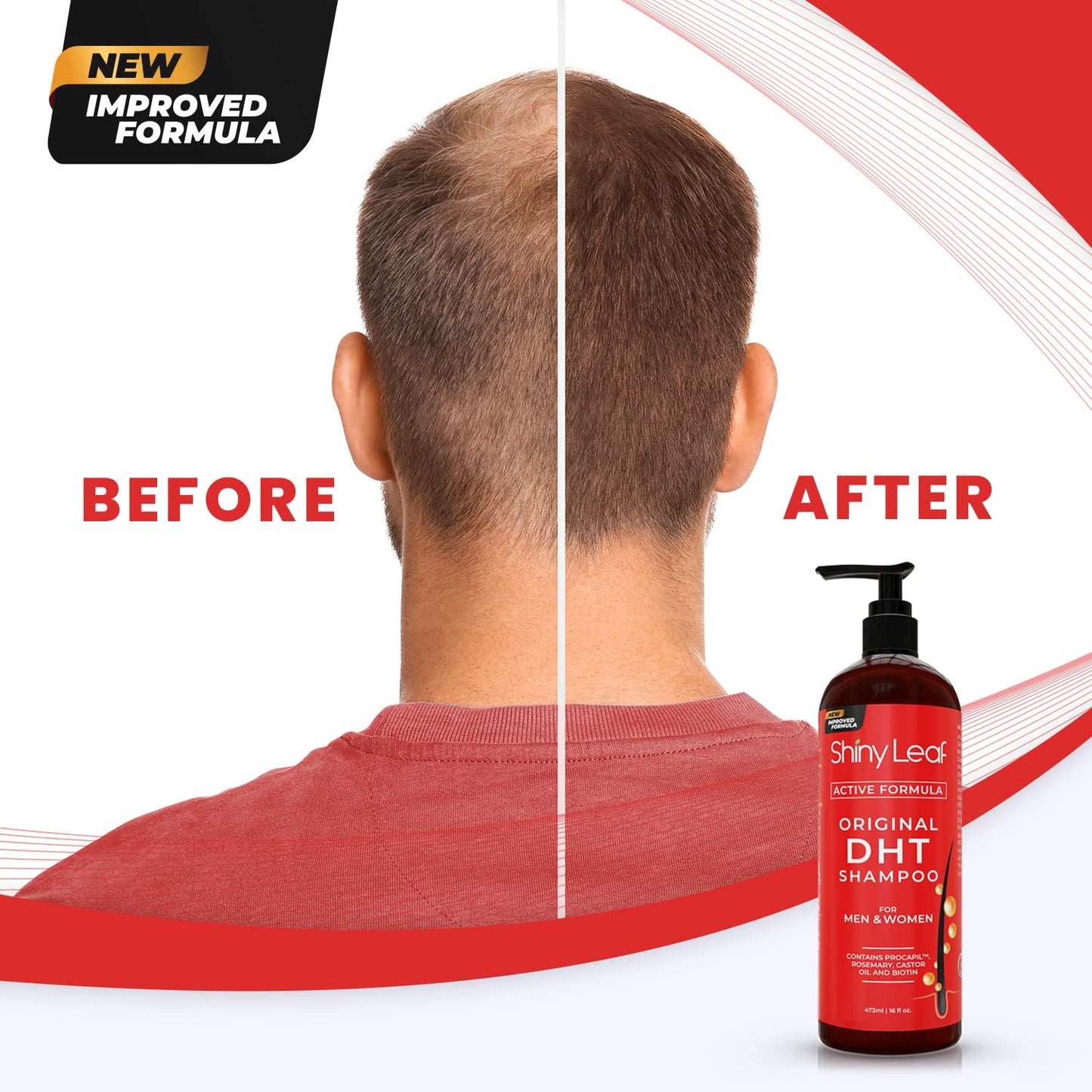 DHT Blocker Shampoo and Conditioner for Hair Loss With Biotin For Men, Women, Anti-Hair Loss Treatment, Rosemary Leaf Oil and Asparagus Extracts, for Thinning Hair (Shampoo and Conditioner) (1 Set)