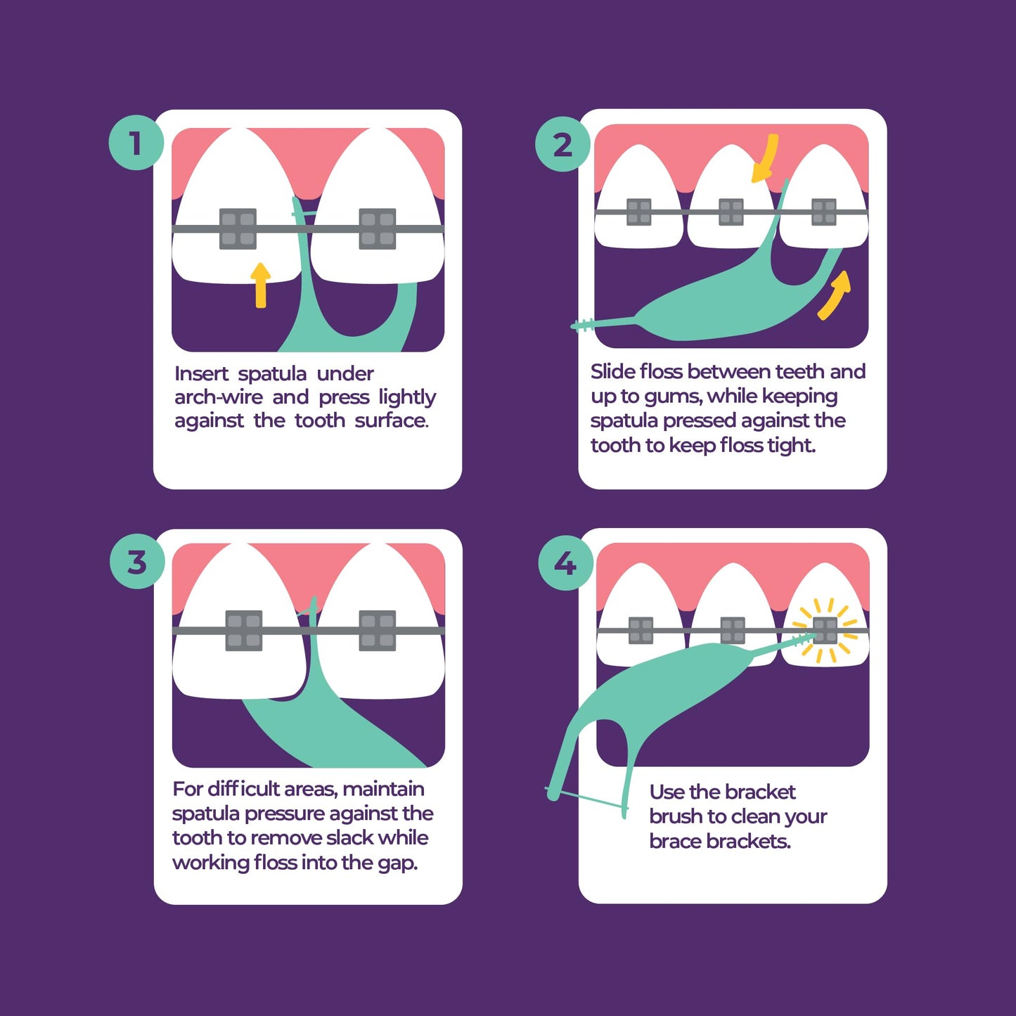 Platypus Orthodontic Flossers for Braces Family Pak - Unique Structure Fits Under Arch Wire, Increase Flossing Compliance, Floss Teeth in Less Than Two Minutes - 75 3-Count Flossers (225 Total)