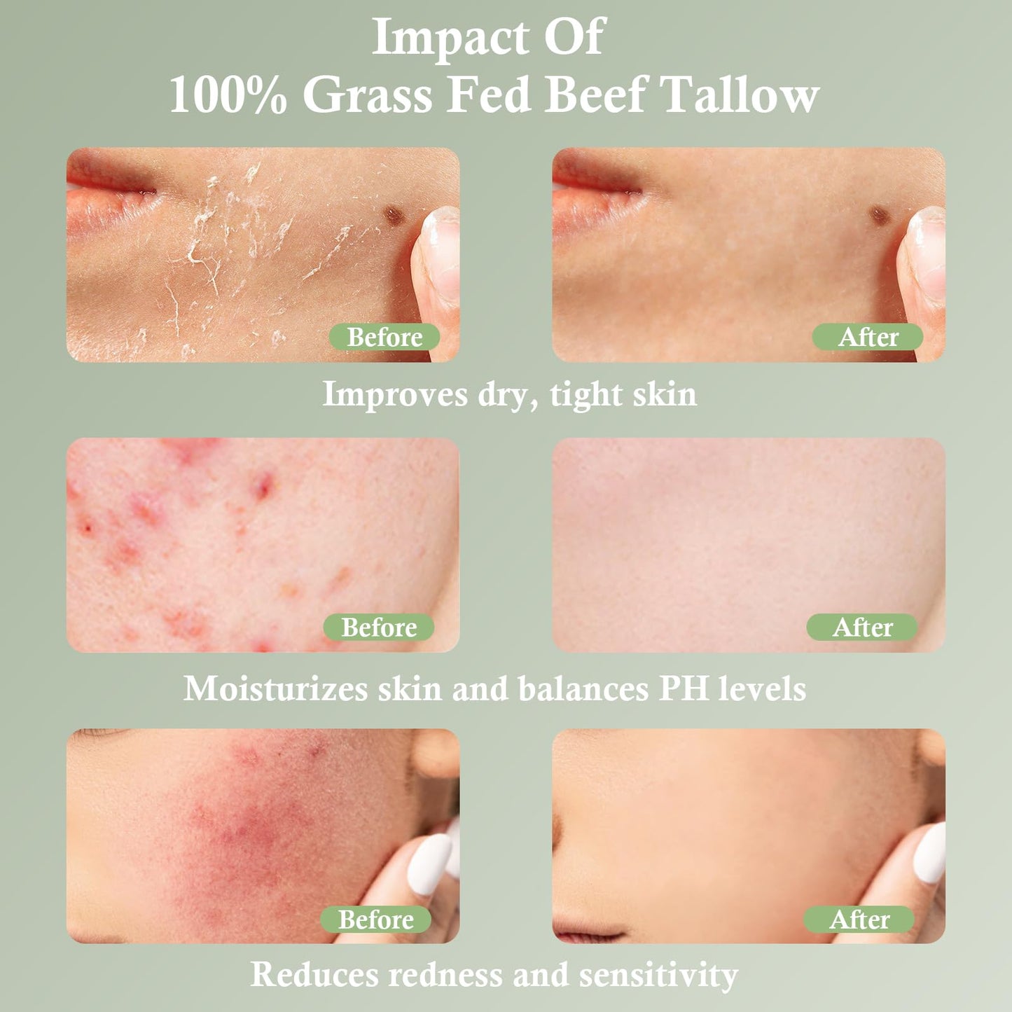 mkzea Beef Tallow, Beef Tallow for Skin, Tallow Face Moisturizer, Unscented 100% Organic Beef Tallow Blam Grass Fed Whipped Tallow Face Cream Moisturizer Body Lotion Skin Care, 2 packs