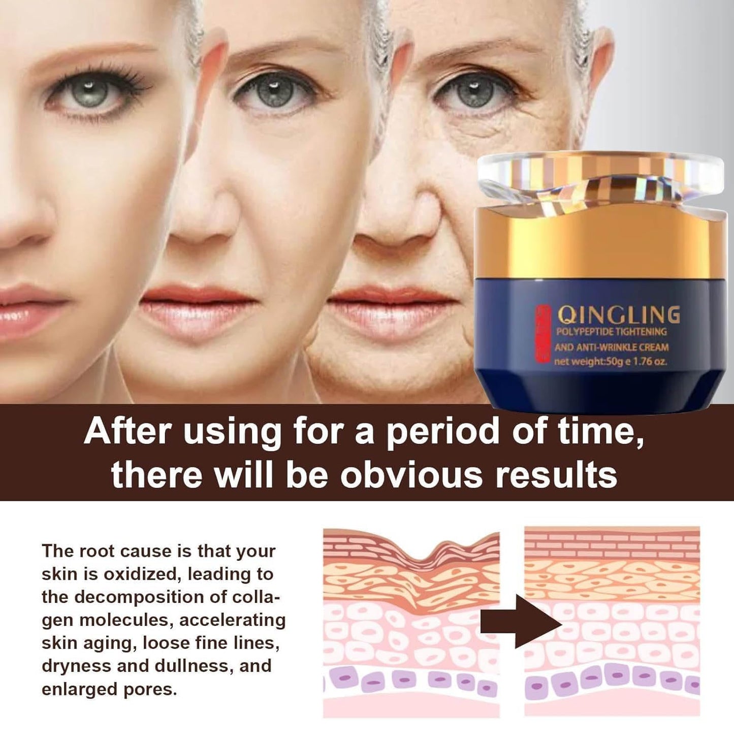 GROHESE Qingling Face Cream, Quinglin Crema Para Arrugas, Qingling Wrinkle Removal Cream, Polypeptide Tightening and Anti-Wrinkle Cream, Facial Neck Eye Cream Anti-Aging for Men & Women (2)