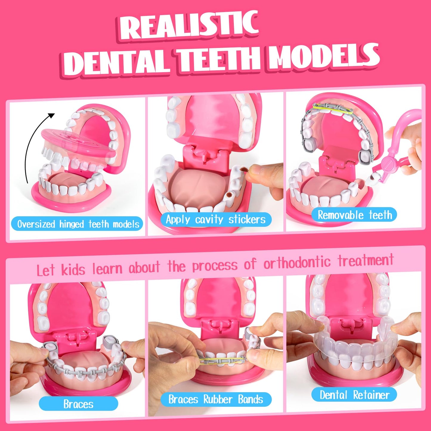 ULOVEME Kids Dentist Play Set Pink with Braces /Removable Teeth /Retainer - Doctor Kit for Toddlers 3-5 - Educational Toys for 4+ Year Old Girls - Pretend Play Toy for Ages 5-7 (Pink)