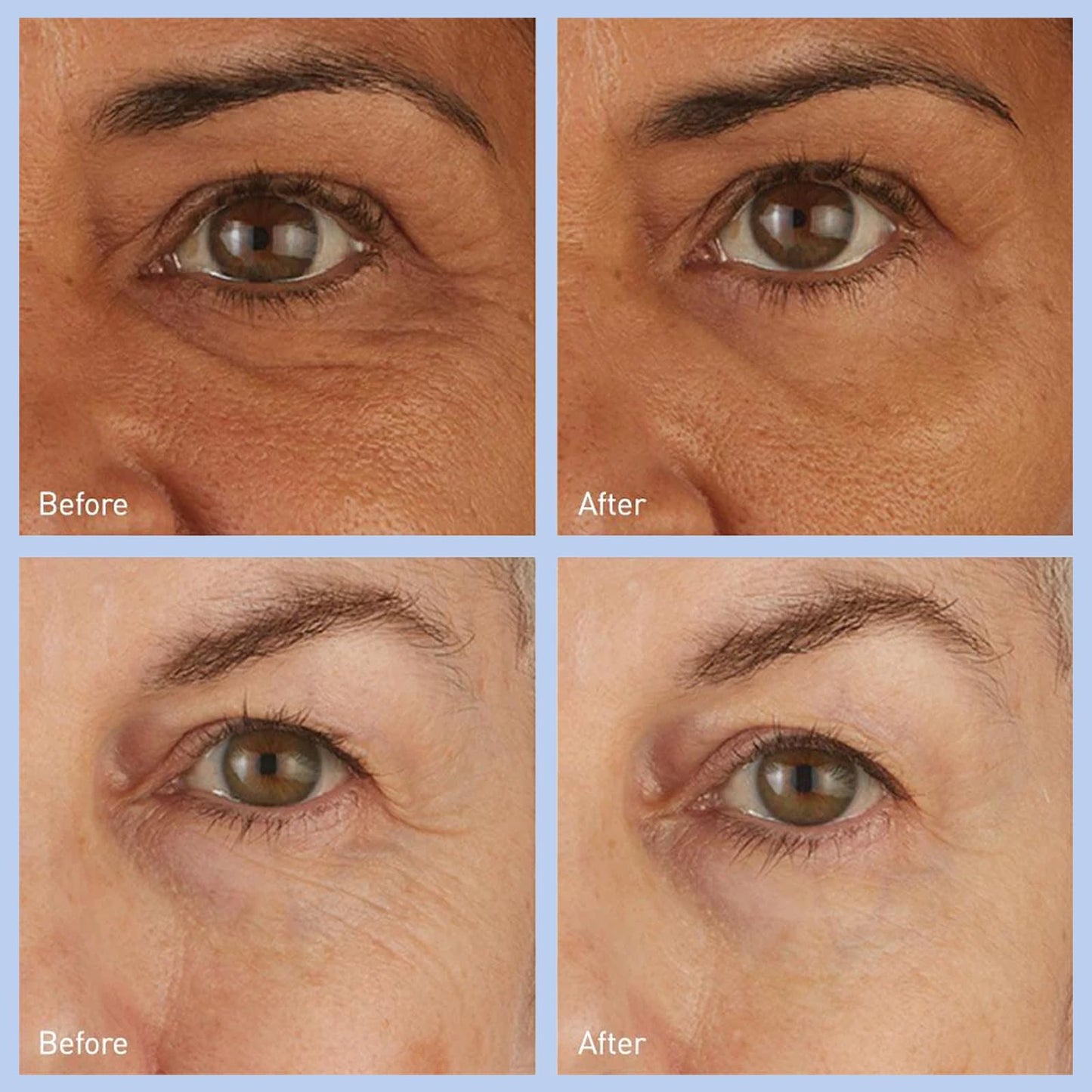 skyn ICELAND Hydro Cool Firming Under Eye Patches Eye Gel Mask To Firm And Reduce Wrinkles Fine Lines Dark Circles Puffiness Bags 16 Pairs