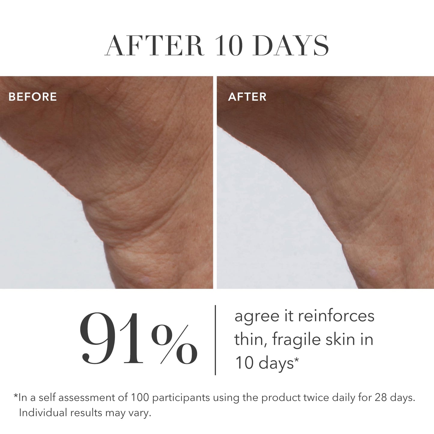 Algenist GENIUS Ultimate Anti-Aging Cream, Travel Size - Vegan Firming & Smoothing Moisturizer with Alguronic Acid & Microalgae Oil - Non-Comedogenic & Hypoallergenic Skincare (15ml / 0.5oz)