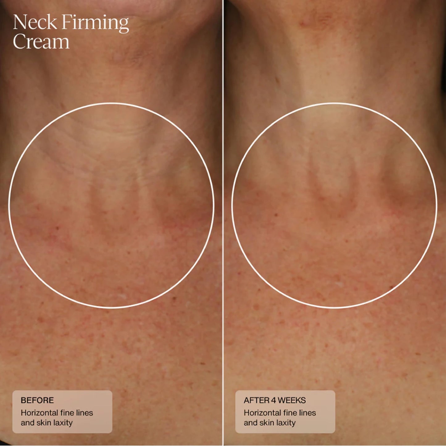 Sente Neck Firming Cream - Advanced Anti-Aging Firming and Lift Cream with Patented HSA, Caffeine and Vitamin C - 1.7 Oz