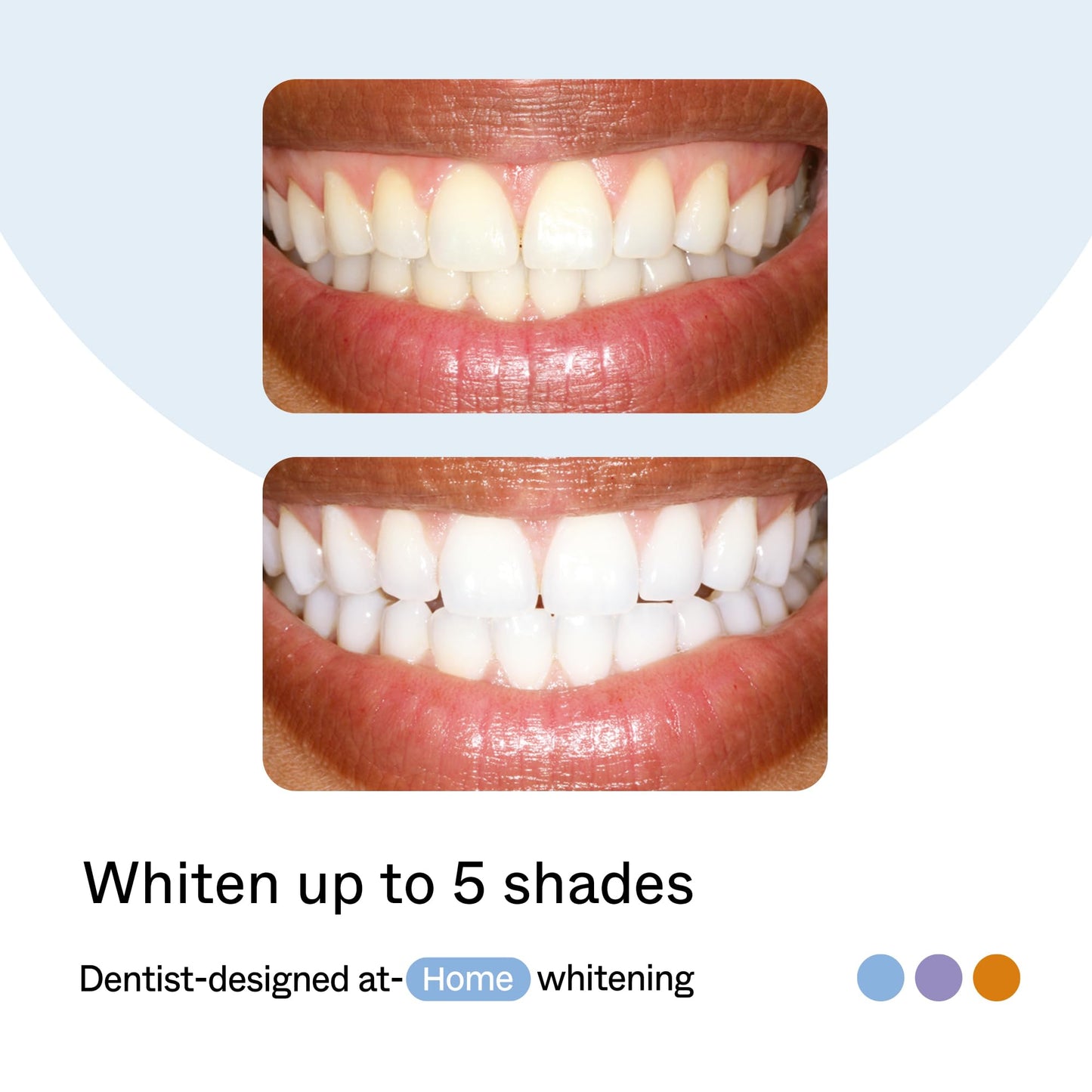 Opalescence Home Advance Gel Prefilled Teeth Whitening Trays 15% – (10 Treatments) Hydrogen Peroxide PF Teeth Whitening Kit – Enhanced Opalescence GO Trays 5822-T