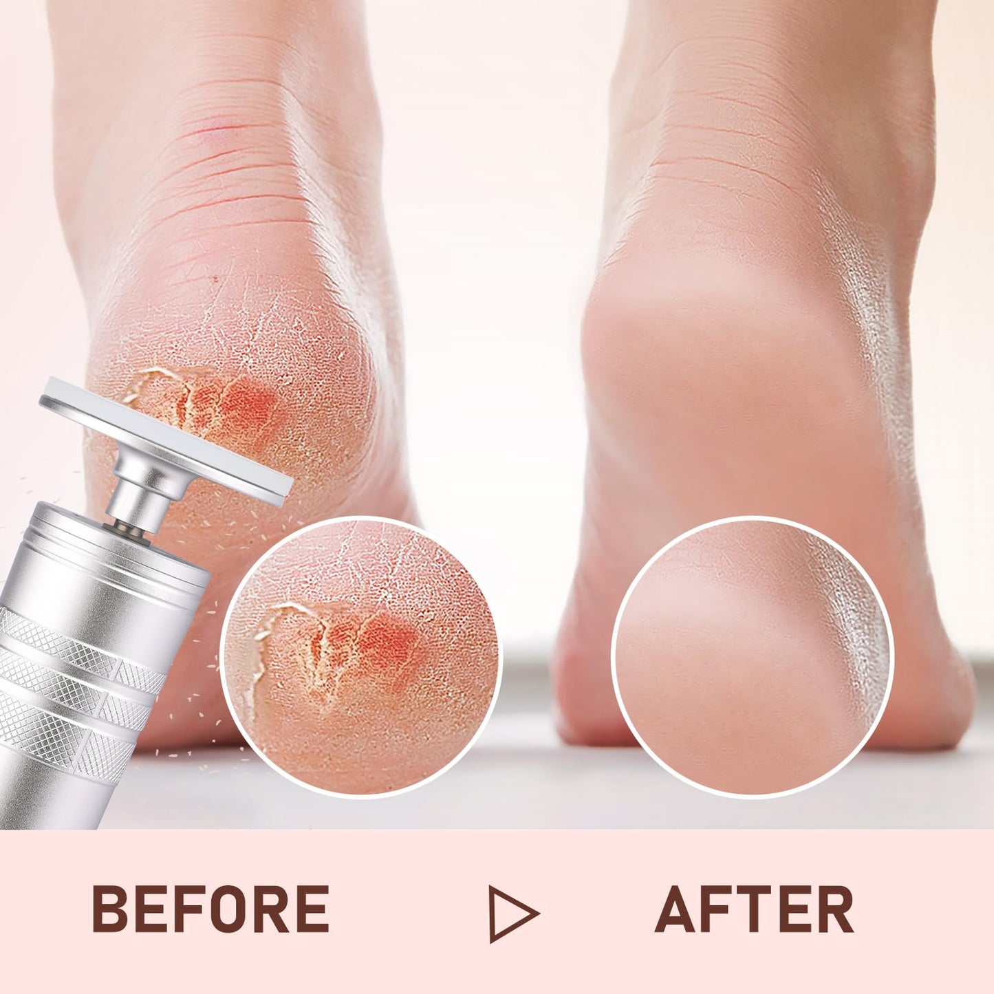 Kredioo Electric Foot Callus Remover 5 Nano Glass Nail File Grinding Heads and Sanding Bands Pedicure Tools for Feet Sensitive Skin Safe Adjust Speed R/F Direction Remove Calluses Dead Dry Skin