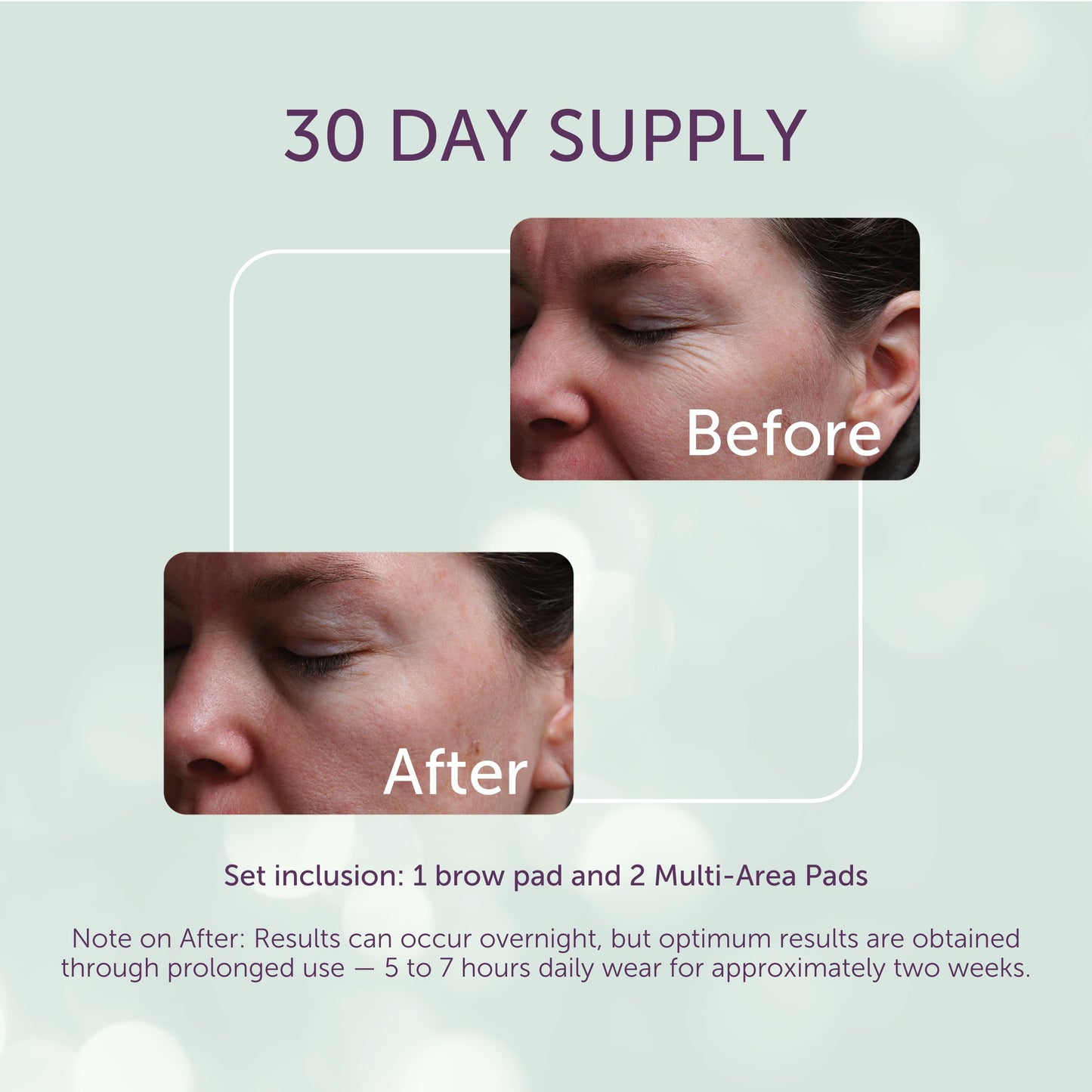 SilcSkin Facial Pads Brow Set - 2 Multi Area Pads, 1 Brow Pad - For Forehead and Facial Areas - Reusable Self Adhesive Silicone Face Pads, 30 Day Supply