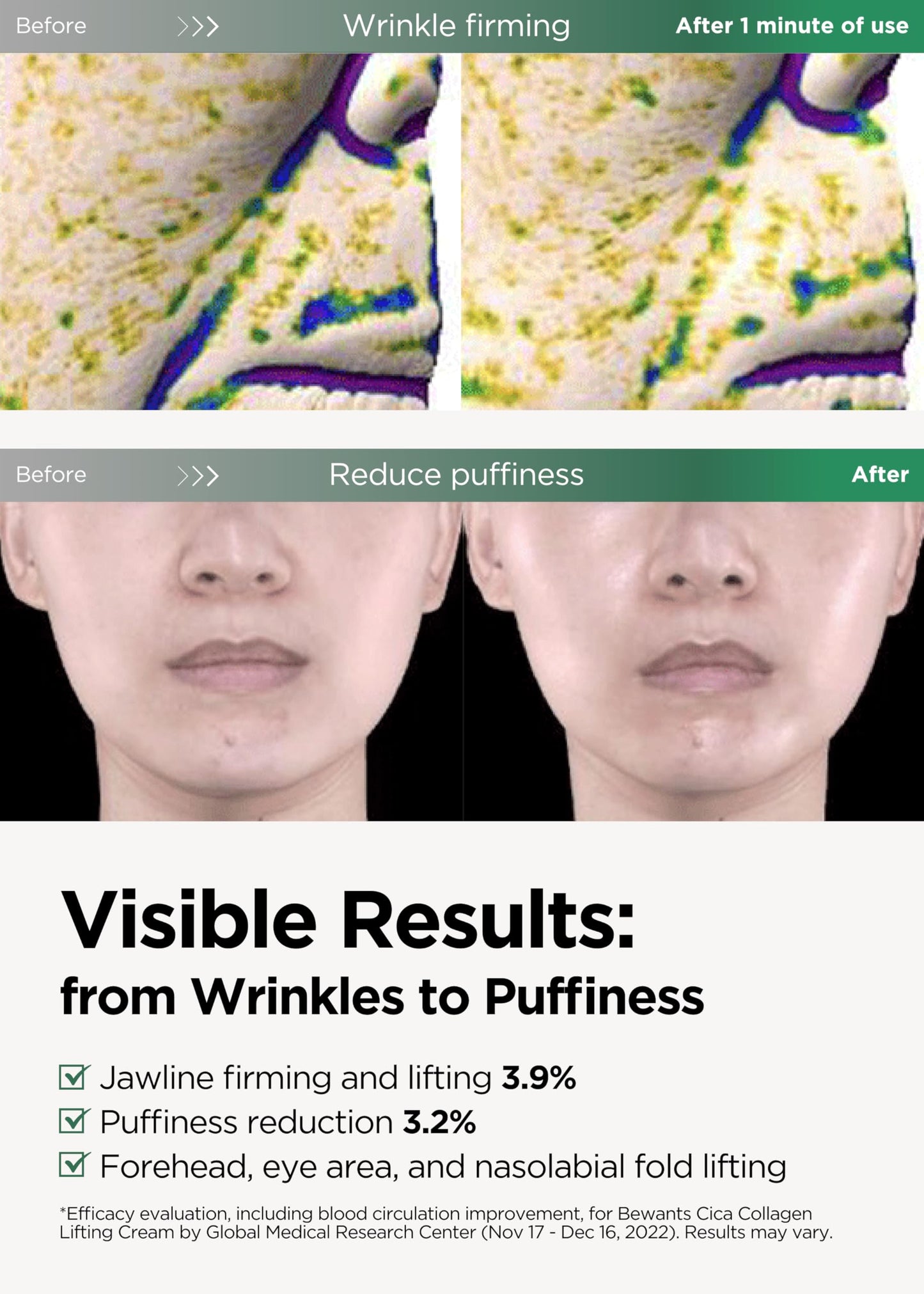 BE+WANTS Bewants Neck Lifting & Firming Cream with Centella Asiatica, Vegan Hyaluronic Acid, Neck and Face Firming Cream Moisturizer For Sagging Skin with Gua Sha Roller