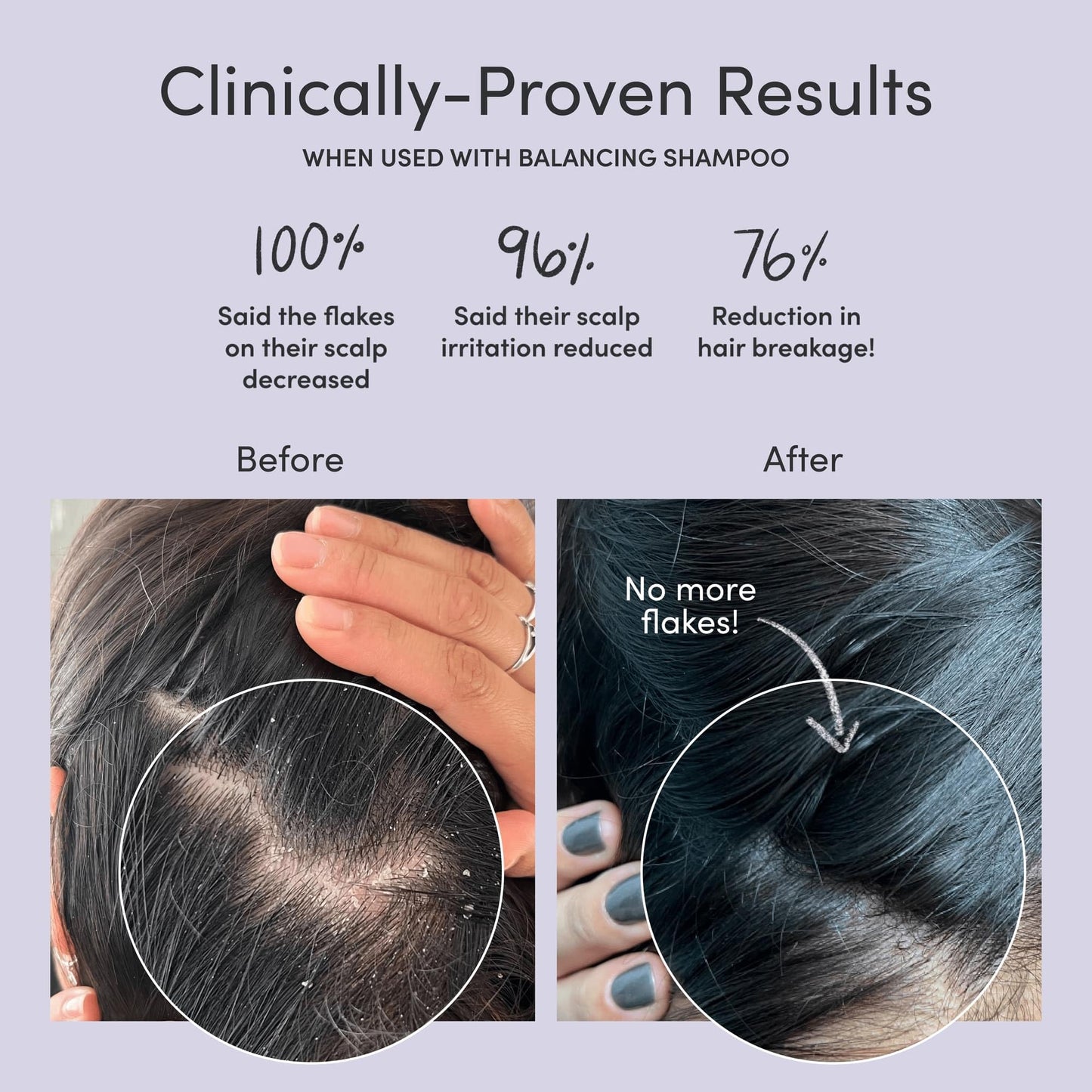 Jupiter, Physician-Formulated Scalp Balancing Conditioner for Dry, Itchy, Oily, Flaky Scalp, Sulfate-Free, Natural Fragrance, Vegan, Color-Safe, & Paraben-Free Conditioner for Women & Men