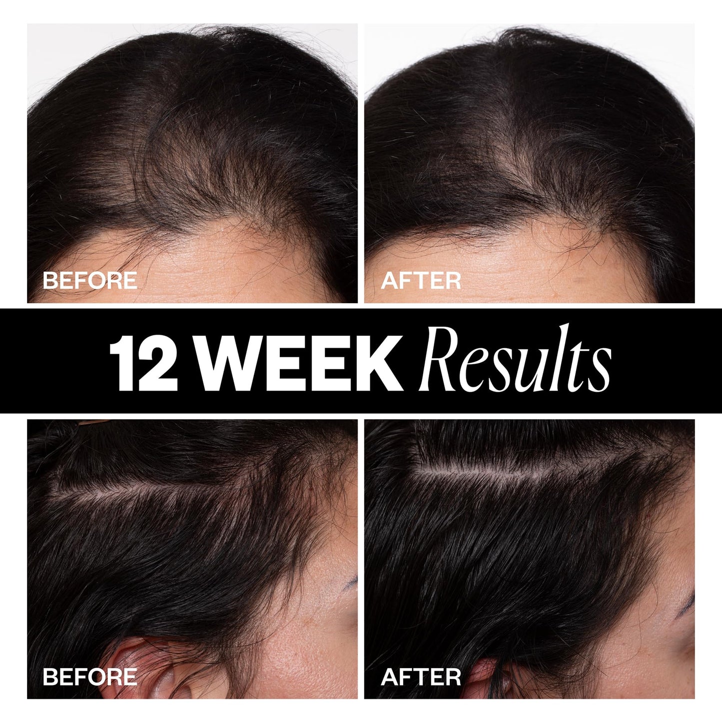 IGK Sponsored Hair Density Scalp Treatment 63 ml / 2.1 oz