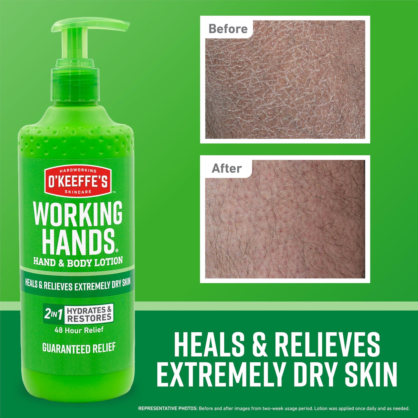O'Keeffe's Working Hands Hand and Body Lotion, 12oz Pump (Pack of 2) - Heals and Relieves Extremely Dry Skin