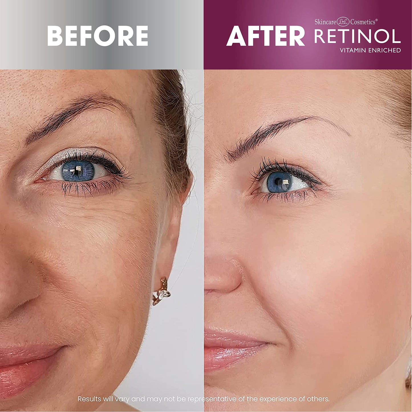 Retinol Night Cream – The Original Anti-Aging Retinol For Younger Looking Skin – Luxurious Restorative Moisturizer Works While You Sleep to Reduce Fine Lines And Other Signs of Aging