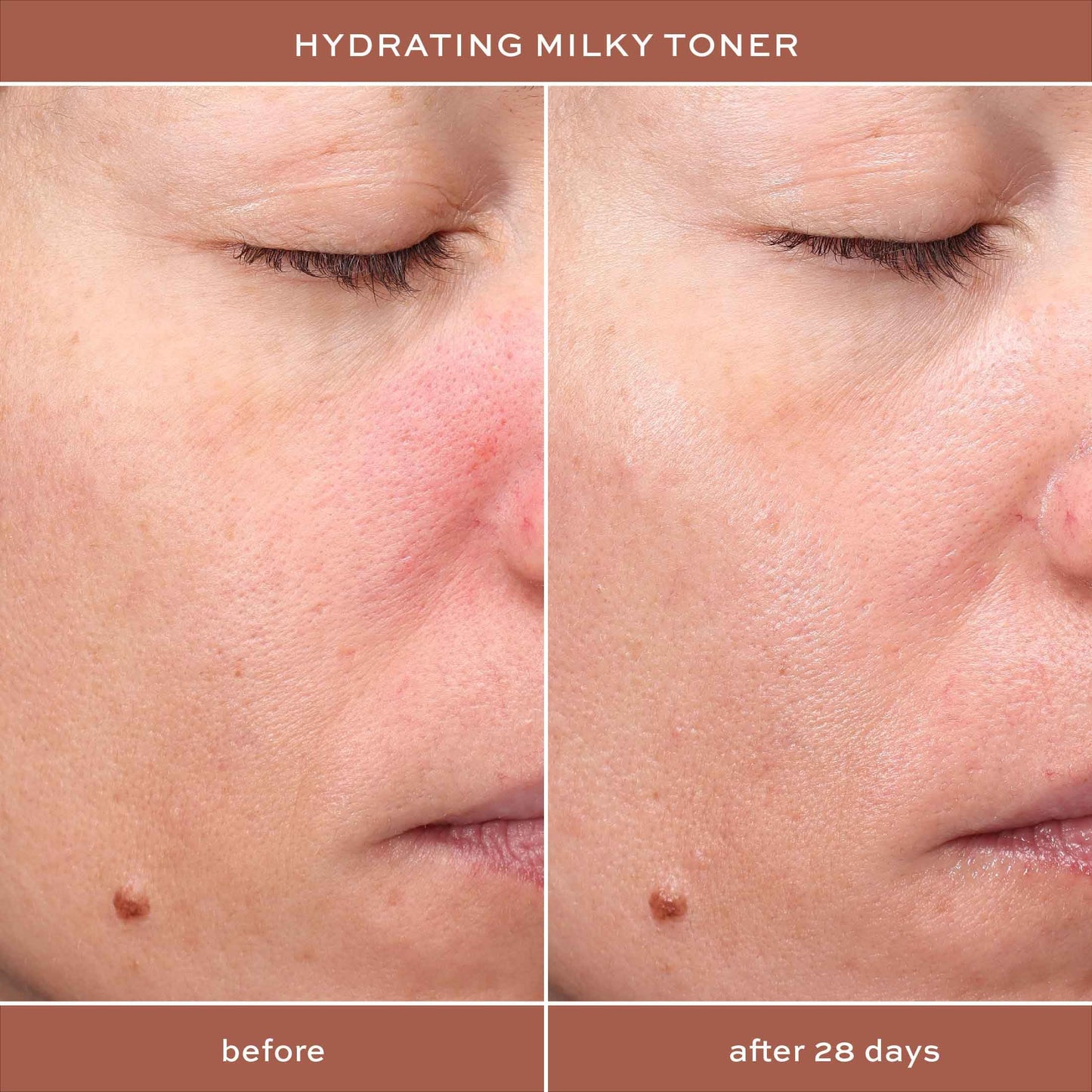 ITK Skincare Glowy Skin 3-Step Routine - Hyaluronic Acid + Niacinamide Serum, Squalane Milky Toner, Deep Moisture Ceramide Face Cream Moisturizer - Makeup Prep Skincare for Glowing Hydrated Skin