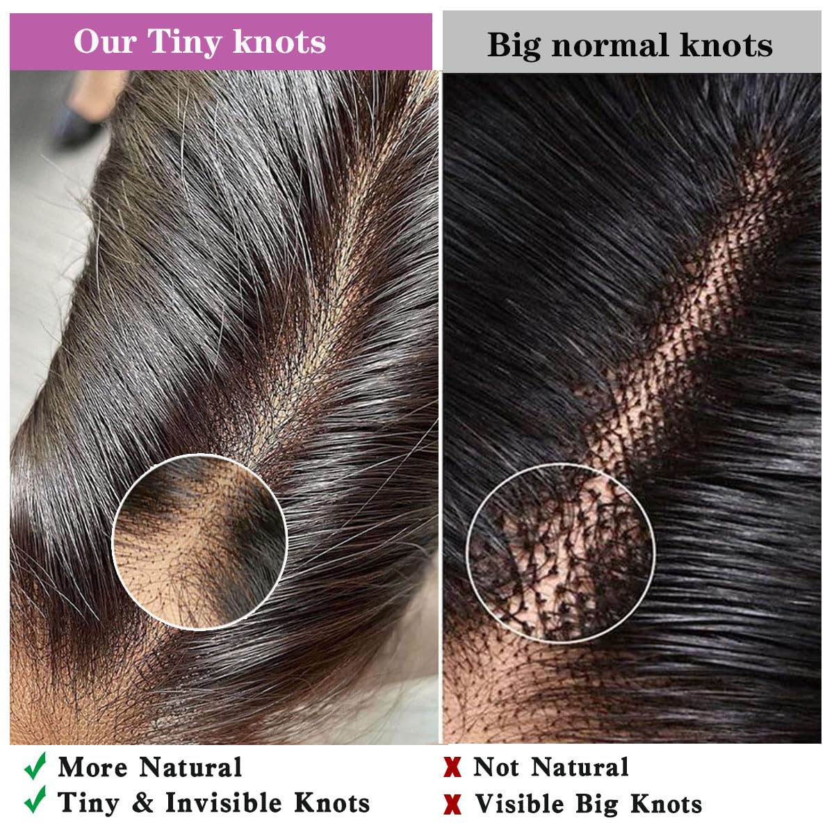 Mnador 2x6 SKINLIKE Real HD Lace Closure Deep Parting Straight Human Hair 0.095mm Ultra-thin hd lace Closure Tiny knots Brazilian Virgin Human Hair Closure pre plucked with Natural Hairline, 16inch