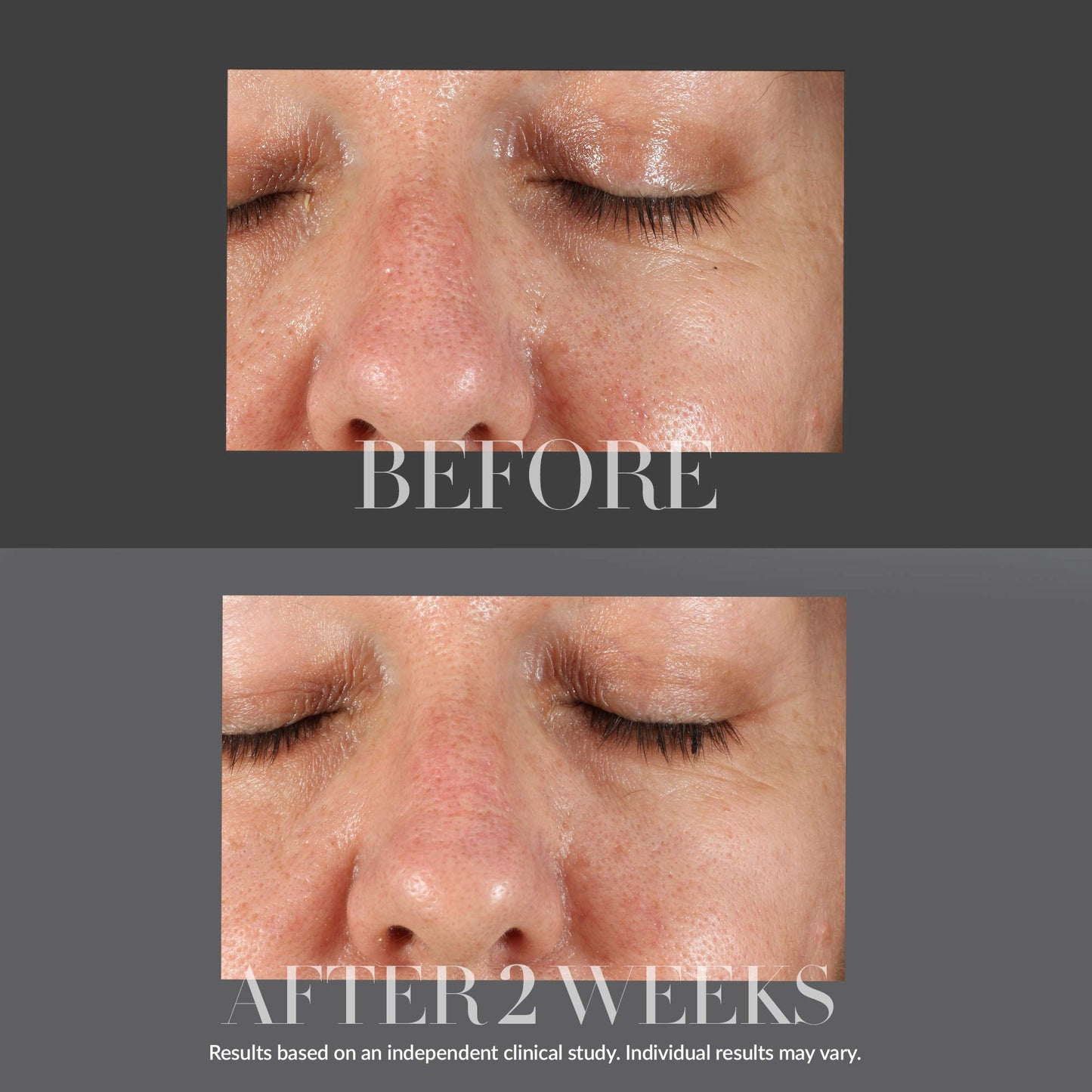 Kate Somerville KateCeuticals Resurfacing Overnight Peel | Clinic-Grade Face Peel | Powerful Anti-Aging Treatment | 1 Fl Oz