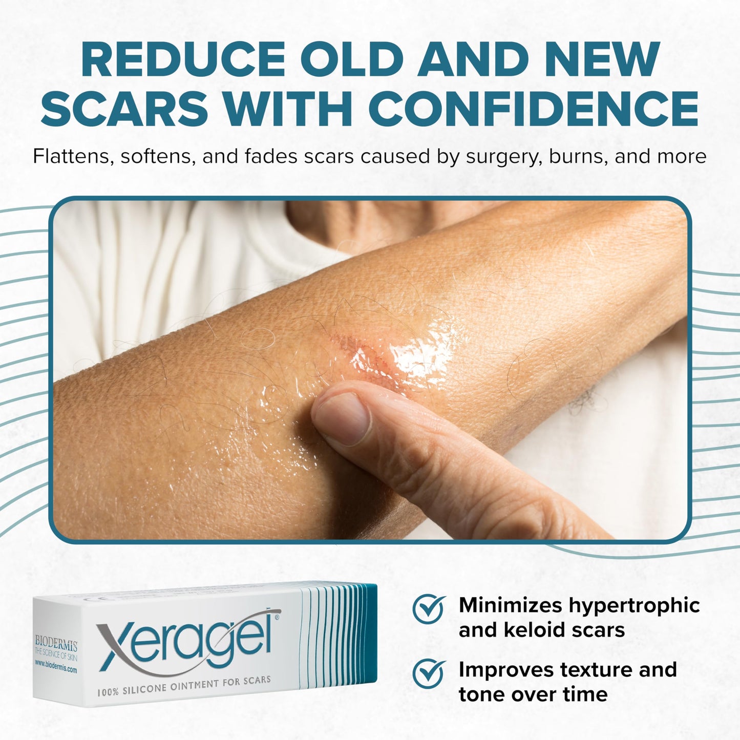 Xeragel 100% Silicone Scar Treatment Ointment 10g – Scar Gel for Smoother, Flatter Scars from Surgery, Burns, Acne & More - For Old & New Scars on Face, Neck & Hands - Hypoallergenic & Fragrance-free