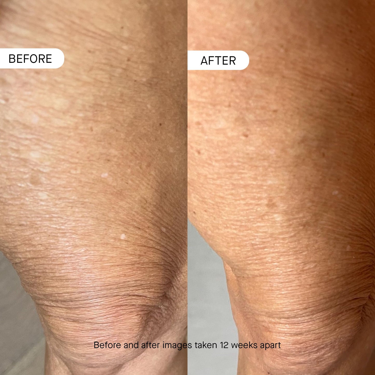 OneSkin BODY OS-01 Peptide Skin Longevity Daily Moisturizer- Improves Skin Texture & Barrier, For All Skin Types Including Sensitive Skin