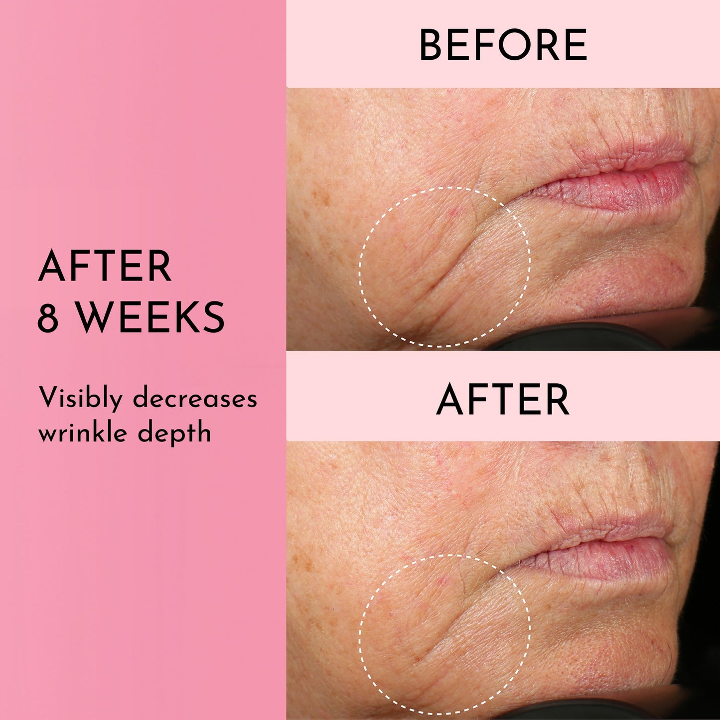 Lawless Forget the Filler Perfecting Cream