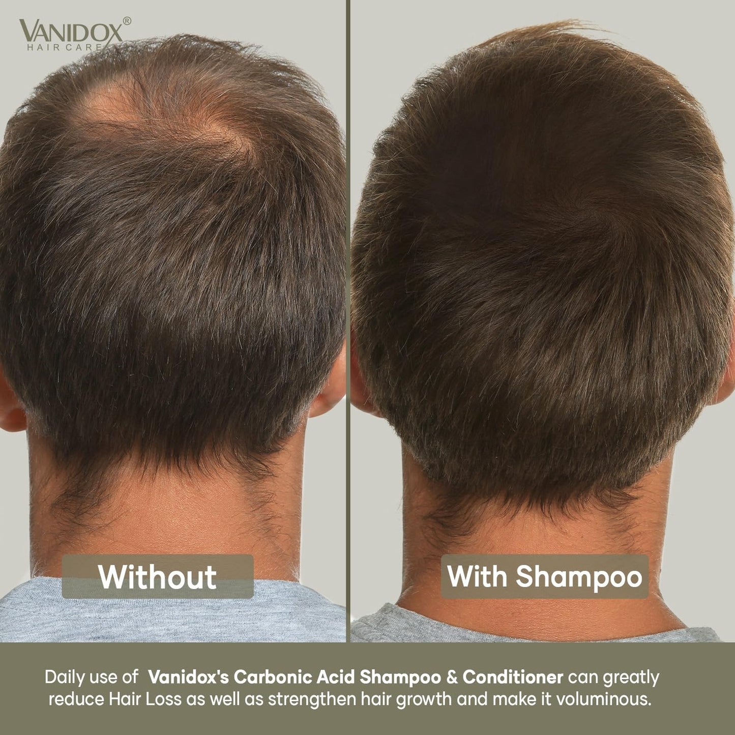 VANIDOX Carbonic Acid Shampoo and Conditioner for Men and Women, Deep Moisturizing Conditioner, Thickens, Softens, & Smooths Set for Hair Growth and Repair, Made in USA - 16 Fl Oz Each