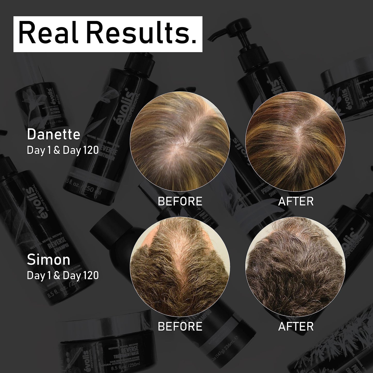 évolis Reverse Repair Treatment Mask | Deep Conditioning Hair Mask for Hair Growth & Repair | Safe for Color Treated Hair (8.5 fl oz)