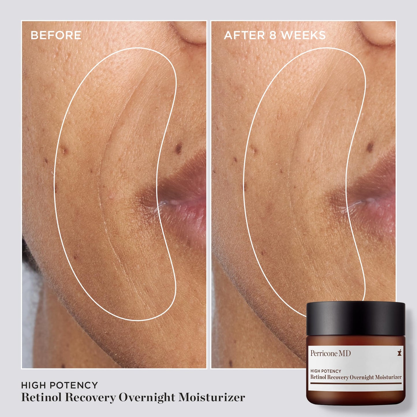 High Potency Retinol Recovery Overnight Moisturizer, 2 fl. oz.