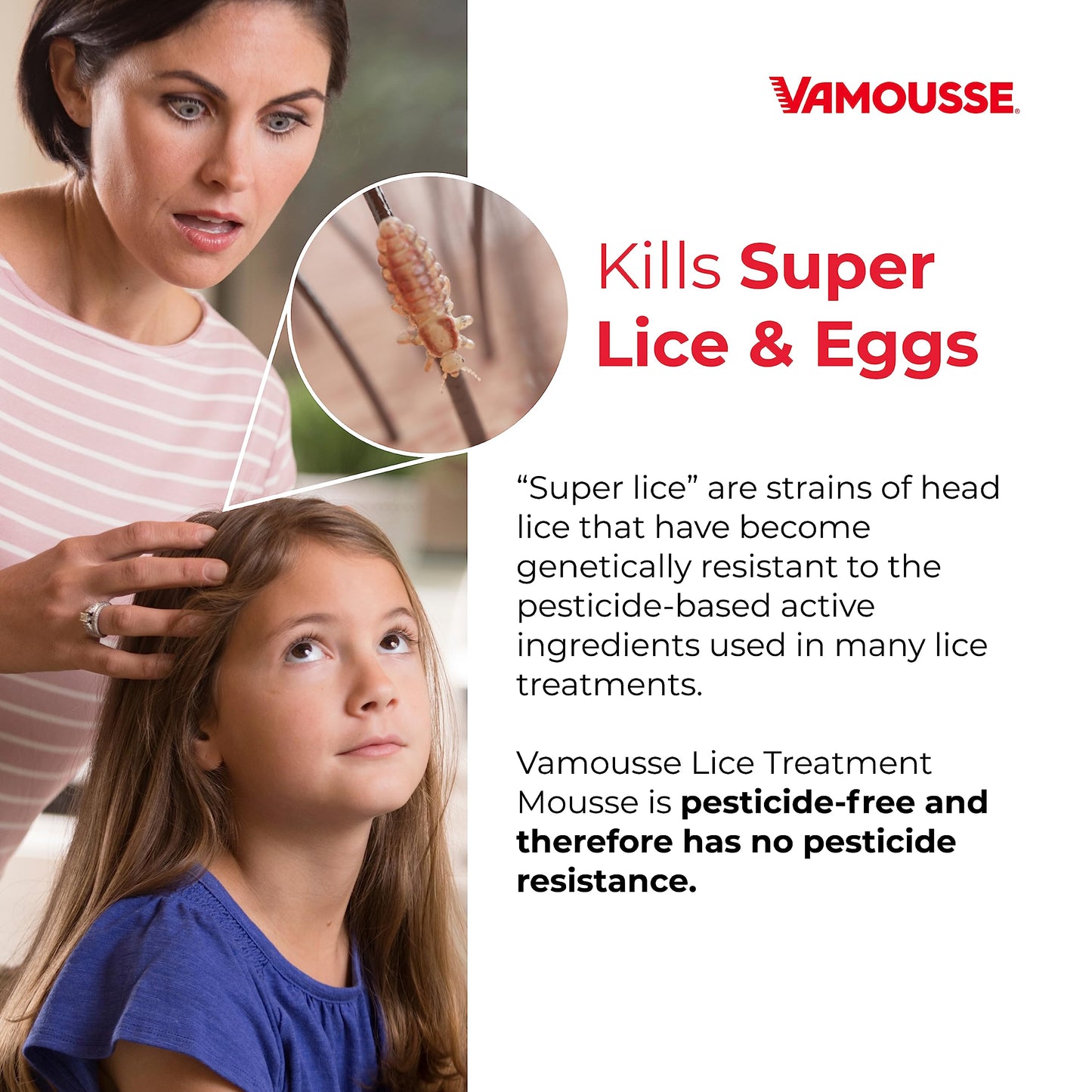 Vamousse PRO Lice Emergency Kit, Includes Lice Treatment Mousse (6 Oz), Daily Shampoo (4 Oz), Repellent Spray (3 Oz), Steel Comb & 2 Clips, for Kids & Adults, Ideal for Daily Use