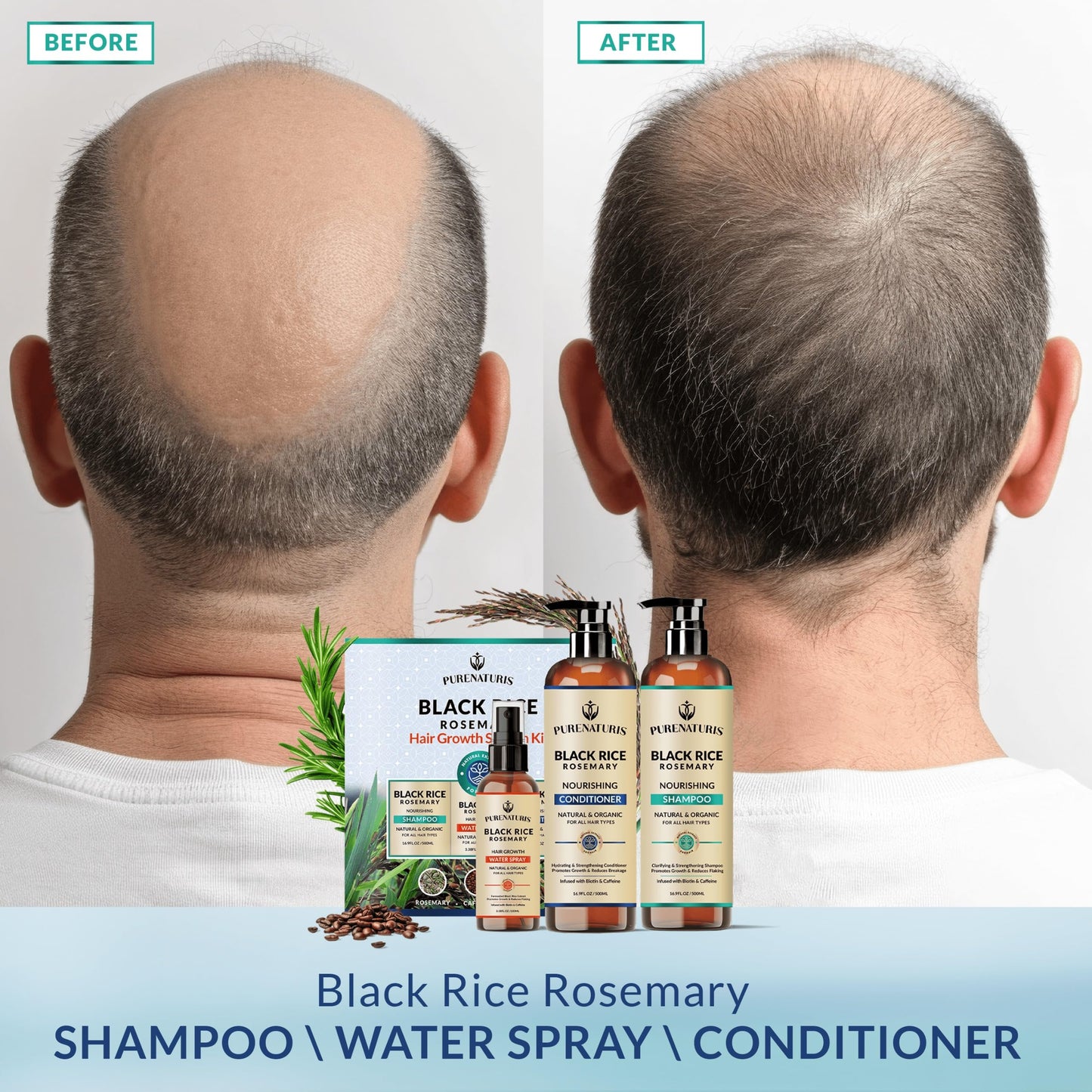 Organic Rosemary Black Rice Water Shampoo Conditioner Set for Hair Growth, Rice Water Spray, w/Rosemary Water, Biotin, Caffeine, Routine Shampoo for Women Men Hair Loss Thickening, Longer